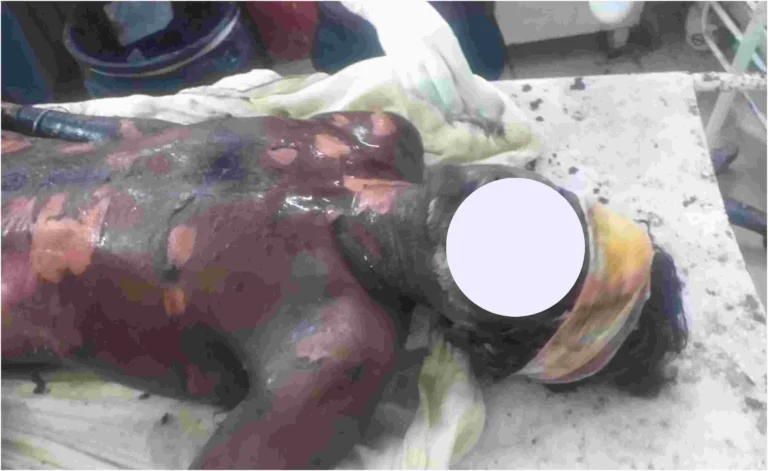 T-20 Sadbhawna Cricket Cup